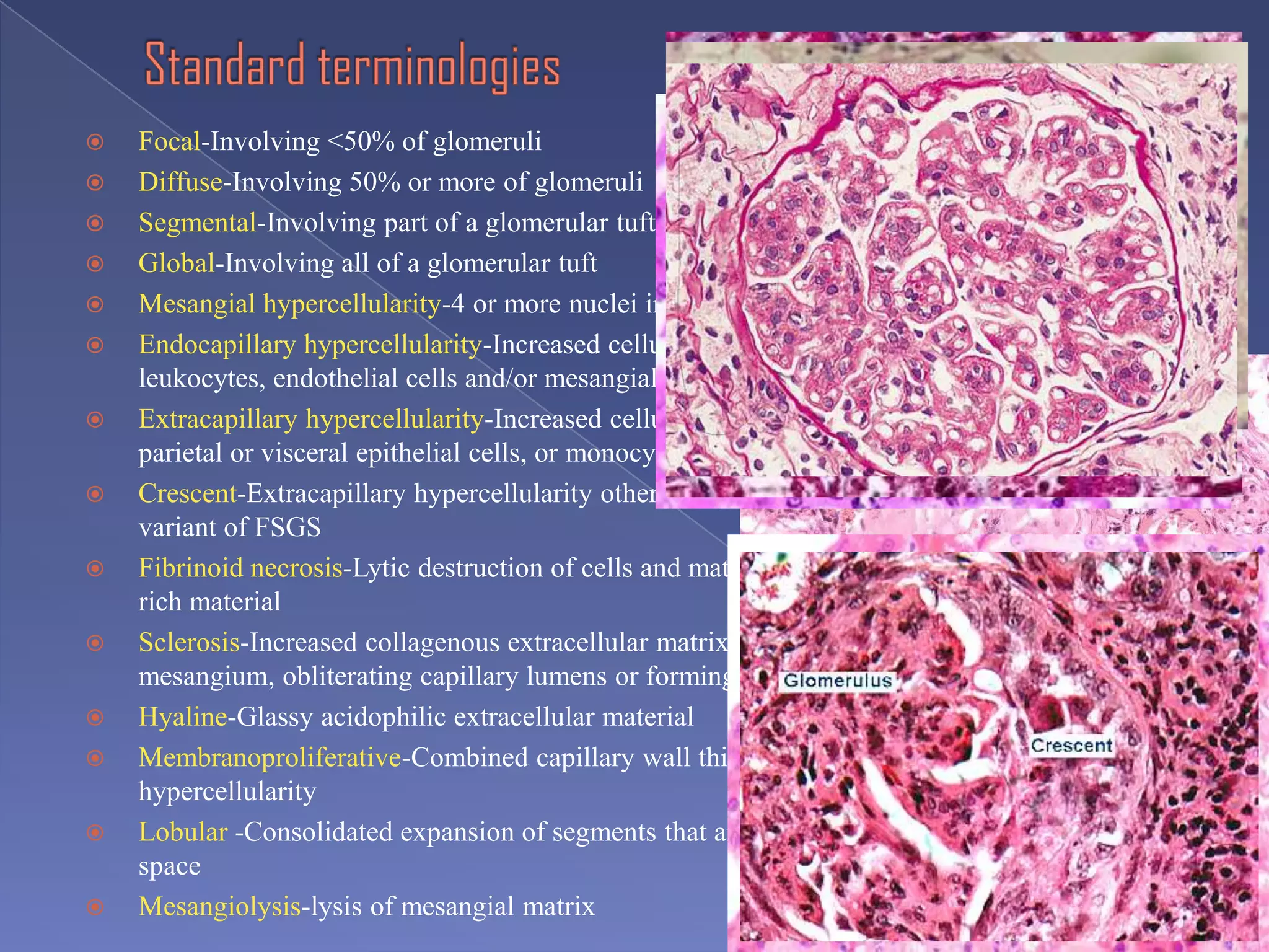  Focal-Involving <50% of glomeruli
 Diffuse-Involving 50% or more of glomeruli
 Segmental-Involving part of a glomerular tuft
 Global-Involving all of a glomerular tuft
 Mesangial hypercellularity-4 or more nuclei in a peripheral mesangial segment
 Endocapillary hypercellularity-Increased cellularity internal to the GBM composed of
leukocytes, endothelial cells and/or mesangial cells
 Extracapillary hypercellularity-Increased cellularity in Bowman’s space, i.e. > one layer of
parietal or visceral epithelial cells, or monocytes/macrophages
 Crescent-Extracapillary hypercellularity other than the epithelial hyperplasia of collapsing
variant of FSGS
 Fibrinoid necrosis-Lytic destruction of cells and matrix with deposition of acidophilic fibrin-
rich material
 Sclerosis-Increased collagenous extracellular matrix that is expanding the
mesangium, obliterating capillary lumens or forming adhesions to Bowman’s capsule
 Hyaline-Glassy acidophilic extracellular material
 Membranoproliferative-Combined capillary wall thickening and endocapillary
hypercellularity
 Lobular -Consolidated expansion of segments that are demarcated by intervening urinary
space
 Mesangiolysis-lysis of mesangial matrix
 