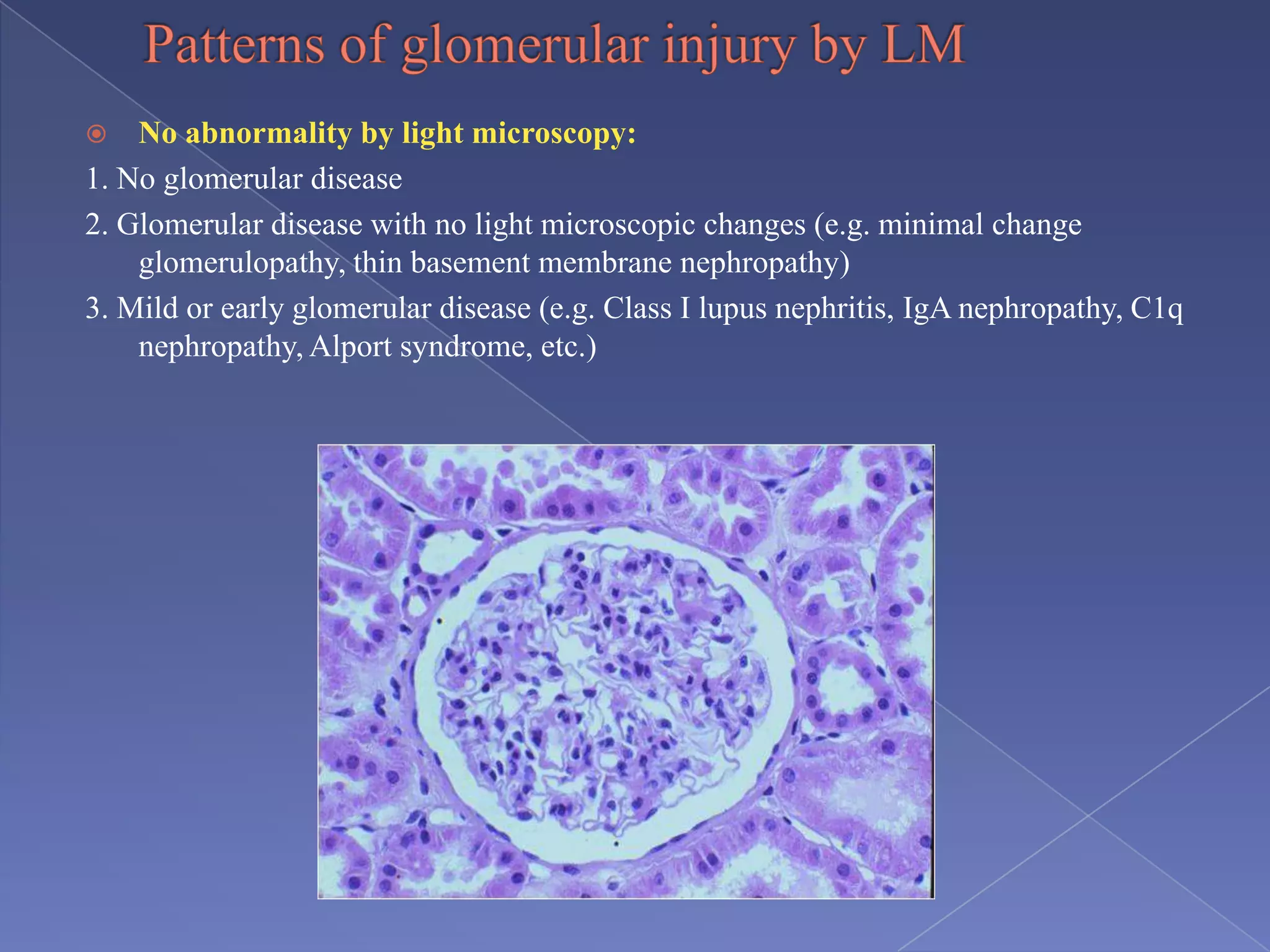  No abnormality by light microscopy:
1. No glomerular disease
2. Glomerular disease with no light microscopic changes (e.g. minimal change
glomerulopathy, thin basement membrane nephropathy)
3. Mild or early glomerular disease (e.g. Class I lupus nephritis, IgA nephropathy, C1q
nephropathy, Alport syndrome, etc.)
 