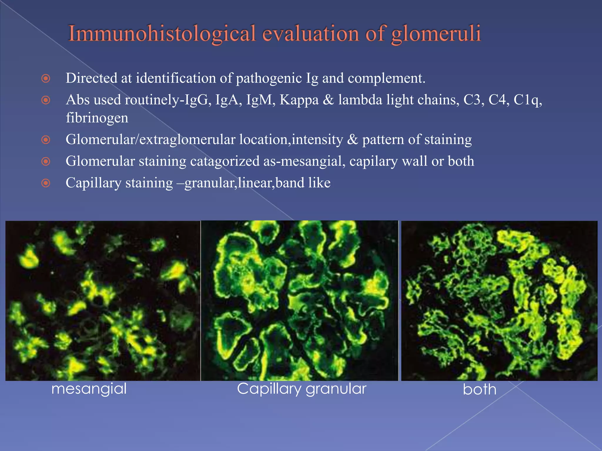 Directed at identification of pathogenic Ig and complement.
 Abs used routinely-IgG, IgA, IgM, Kappa & lambda light chains, C3, C4, C1q,
fibrinogen
 Glomerular/extraglomerular location,intensity & pattern of staining
 Glomerular staining catagorized as-mesangial, capilary wall or both
 Capillary staining –granular,linear,band like
Capillary granularmesangial both
 