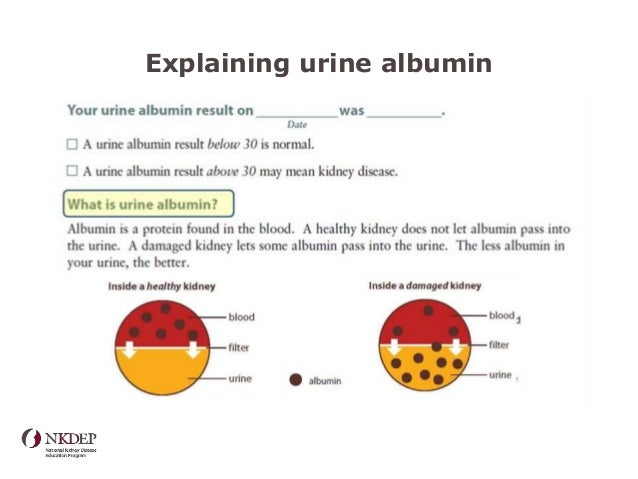 Interpretation of renal diagnostic tests