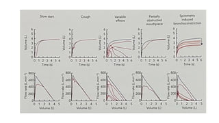 Spirometry Guide.pdf Comprehensive Guide to Spirometry Result Interpretation and Lung ...