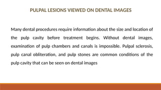 Pulpak Patch Interpretation of Trauma, Pulpal Lesions2026.pptx