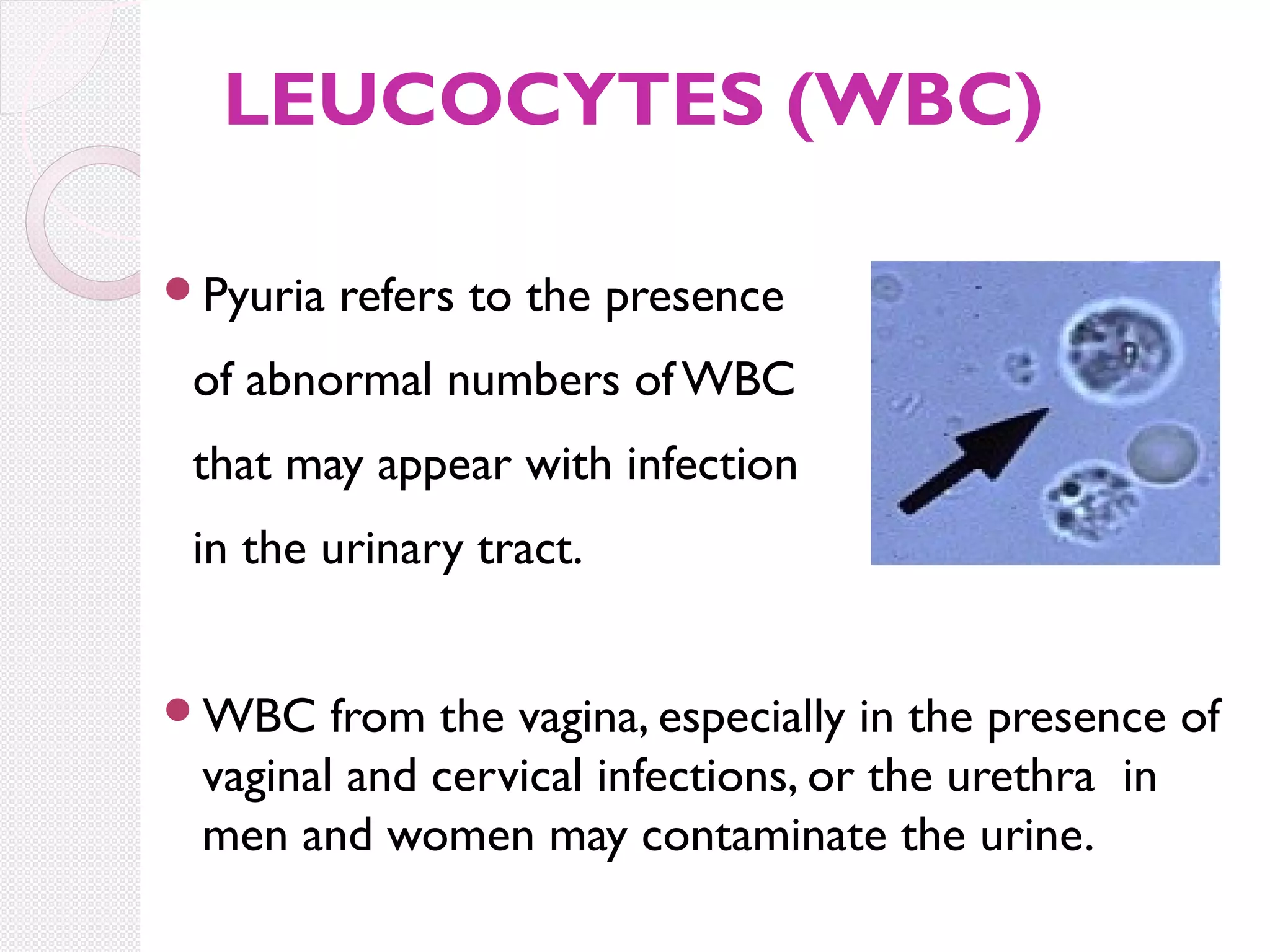 LEUCOCYTES (WBC)
Pyuria

refers to the presence

of abnormal numbers of WBC
that may appear with infection
in the urinary tract.
WBC

from the vagina, especially in the presence of
vaginal and cervical infections, or the urethra in
men and women may contaminate the urine.

 