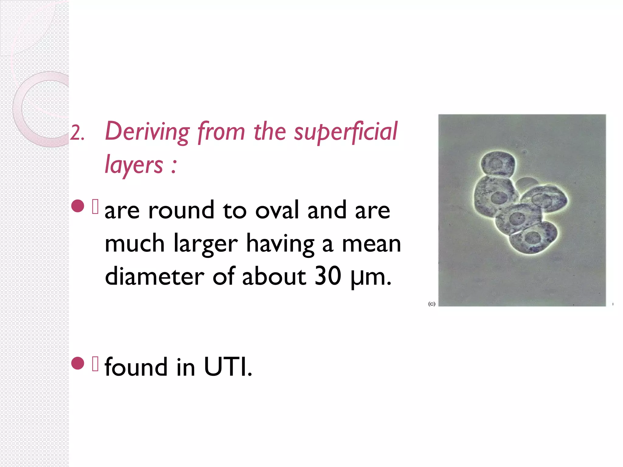 2.

Deriving from the superficial
layers :

. are

round to oval and are
much larger having a mean
diameter of about 30 μm.

. found

in UTI.

 