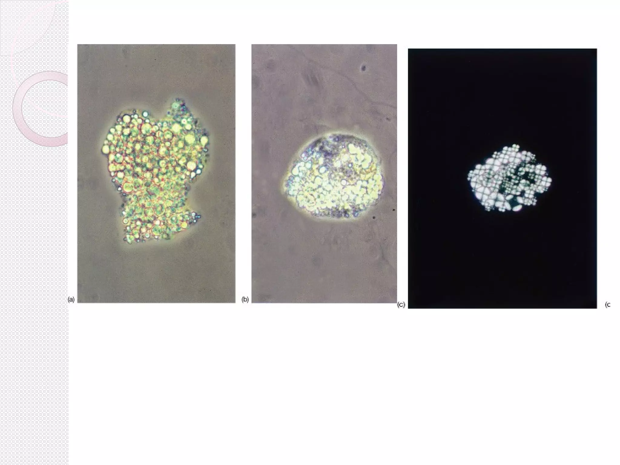 (a) A large aggregate of lipid droplets.
(b) A macrophage partly gorged with lipid droplets (a so-called 'oval fat body').
(c) Maltese crosses

 