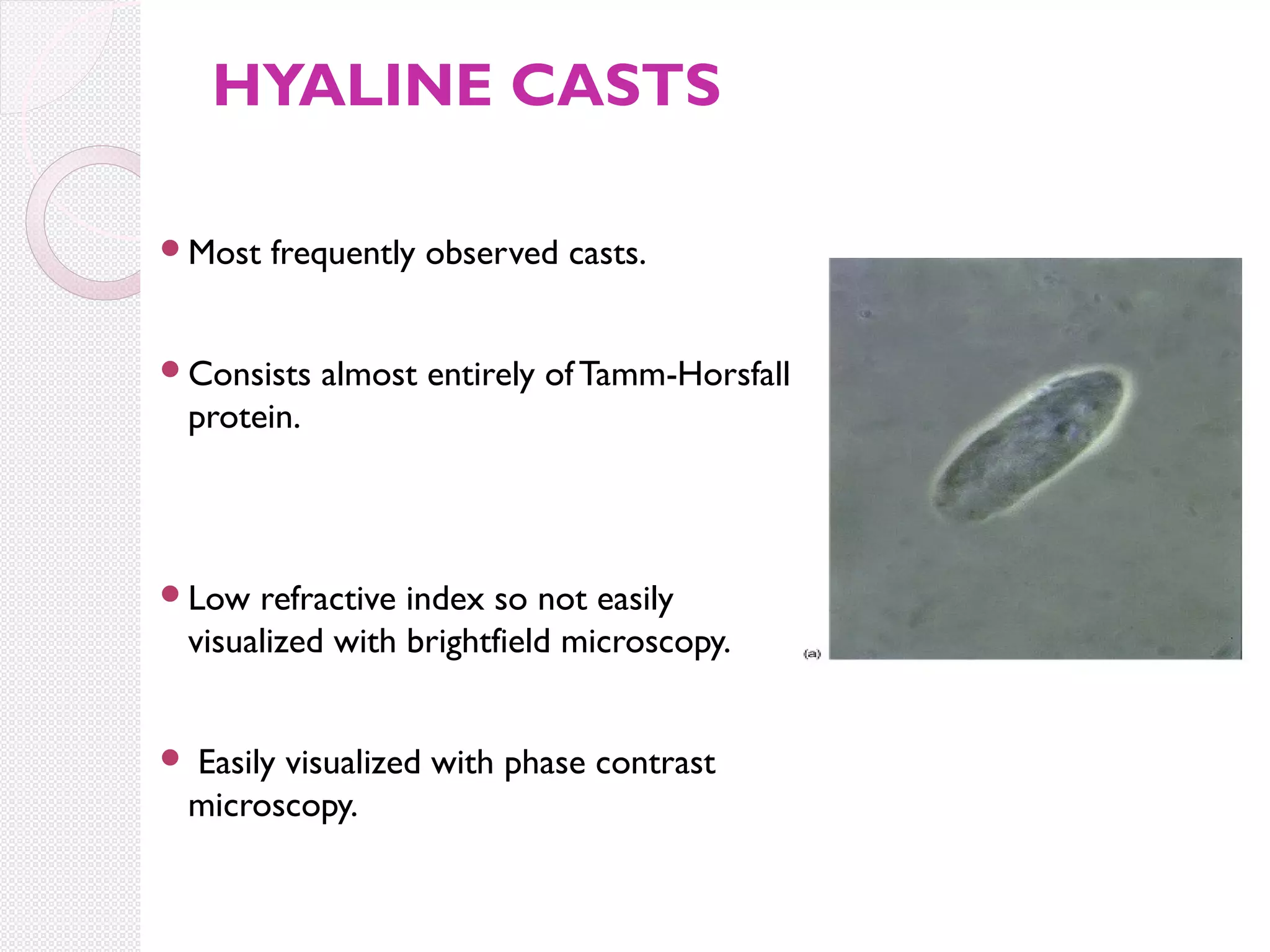 HYALINE CASTS
Most

frequently observed casts.

Consists

almost entirely of Tamm-Horsfall

protein.

Low

refractive index so not easily
visualized with brightfield microscopy.



Easily visualized with phase contrast
microscopy.

 