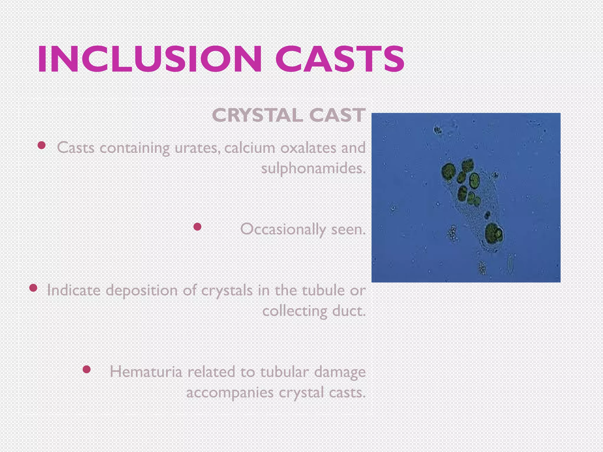 INCLUSION CASTS
CRYSTAL CAST


Casts containing urates, calcium oxalates and
sulphonamides.





Occasionally seen.

Indicate deposition of crystals in the tubule or
collecting duct.



Hematuria related to tubular damage
accompanies crystal casts.

 