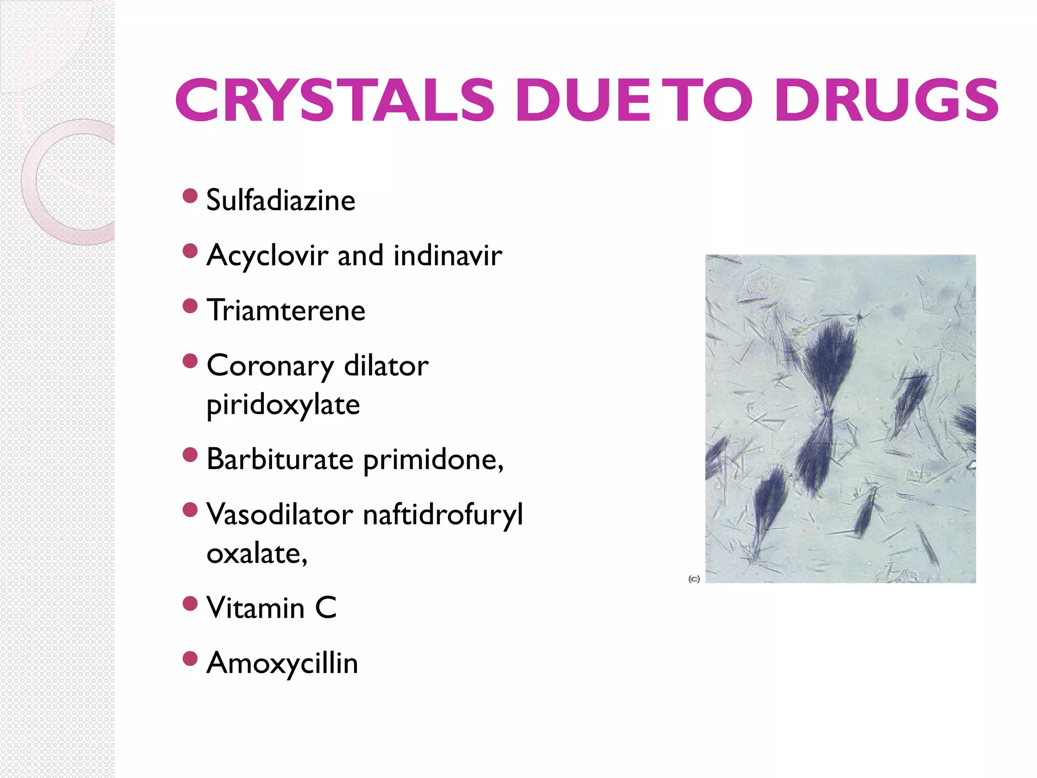 CRYSTALS DUE TO DRUGS
Sulfadiazine
Acyclovir

and indinavir

Triamterene
Coronary

dilator
piridoxylate

Barbiturate

primidone,

Vasodilator

naftidrofuryl

oxalate,
Vitamin

C

Amoxycillin

 