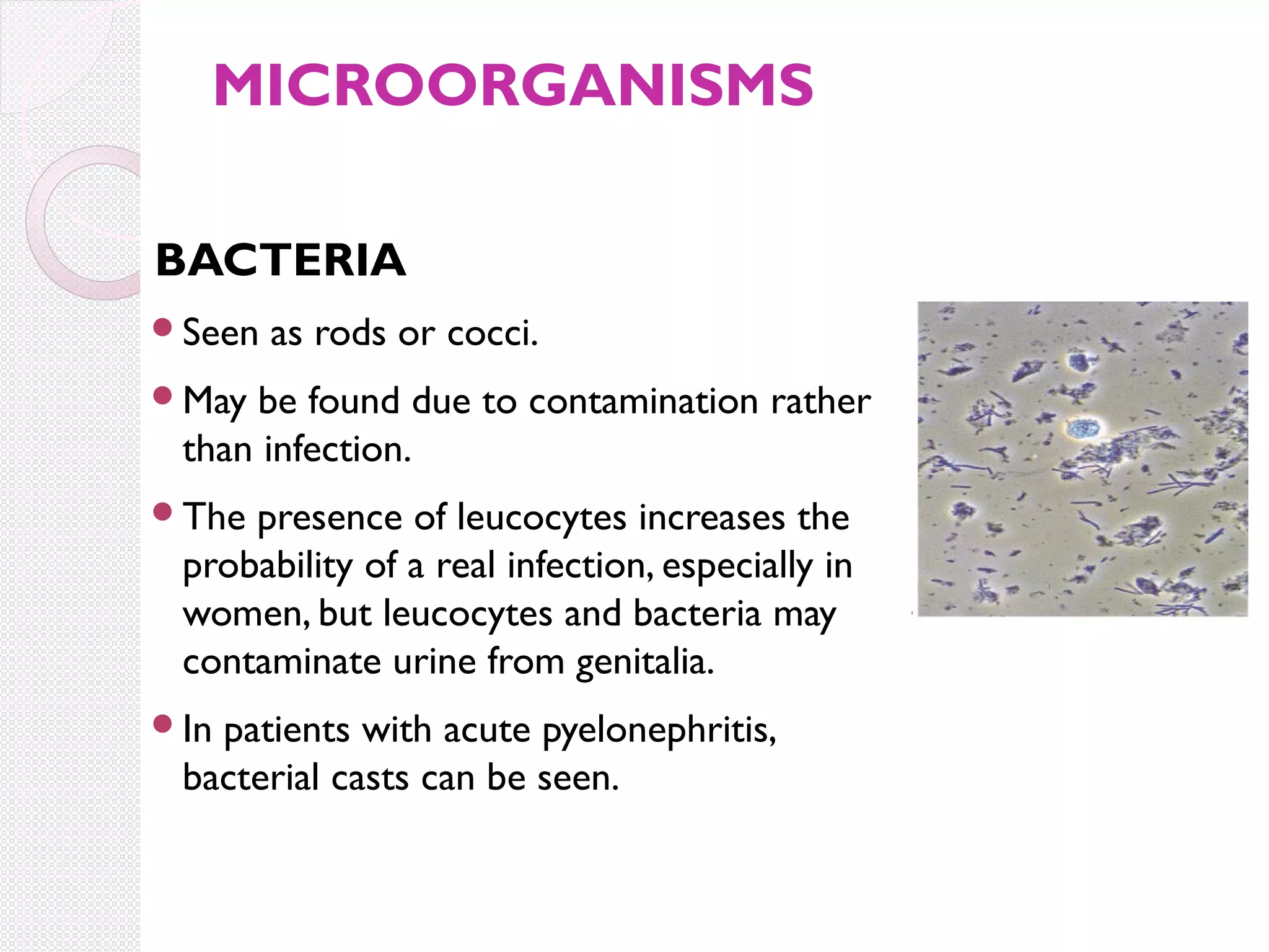 MICROORGANISMS
BACTERIA
Seen

as rods or cocci.

May

be found due to contamination rather
than infection.

The

presence of leucocytes increases the
probability of a real infection, especially in
women, but leucocytes and bacteria may
contaminate urine from genitalia.

In

patients with acute pyelonephritis,
bacterial casts can be seen.

 
