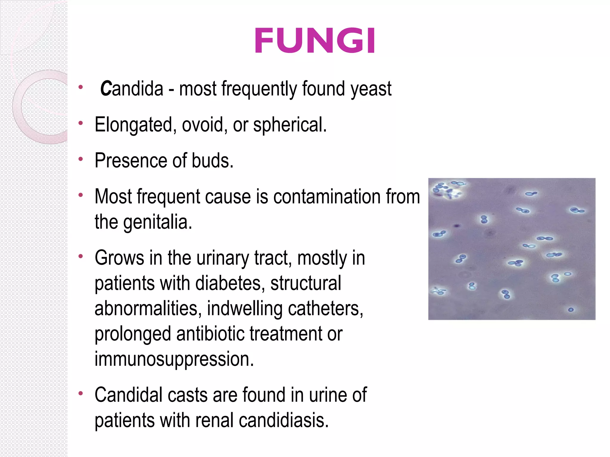 FUNGI
•

Candida - most frequently found yeast

•

Elongated, ovoid, or spherical.

•

Presence of buds.

•

Most frequent cause is contamination from
the genitalia.

•

Grows in the urinary tract, mostly in
patients with diabetes, structural
abnormalities, indwelling catheters,
prolonged antibiotic treatment or
immunosuppression.

•

Candidal casts are found in urine of
patients with renal candidiasis.

 