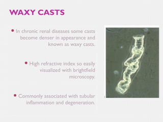 WAXY CASTS
 In

chronic renal diseases some casts
become denser in appearance and
known as waxy casts.
 High

refractive index so easily
visualized with brightfield
microscopy.

 Commonly

associated with tubular
inflammation and degeneration.

 