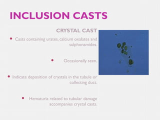 INCLUSION CASTS
CRYSTAL CAST


Casts containing urates, calcium oxalates and
sulphonamides.





Occasionally seen.

Indicate deposition of crystals in the tubule or
collecting duct.



Hematuria related to tubular damage
accompanies crystal casts.

 