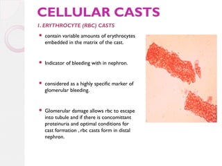 CELLULAR CASTS
1. ERYTHROCYTE (RBC) CASTS


contain variable amounts of erythrocytes
embedded in the matrix of the cast.



Indicator of bleeding with in nephron.



considered as a highly specific marker of
glomerular bleeding.



Glomerular damage allows rbc to escape
into tubule and if there is concomittant
proteinuria and optimal conditions for
cast formation , rbc casts form in distal
nephron.

 