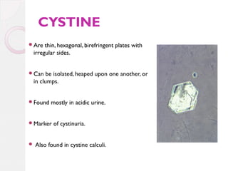 CYSTINE
Are

thin, hexagonal, birefringent plates with
irregular sides.

Can

be isolated, heaped upon one another, or
in clumps.

Found

mostly in acidic urine.

Marker



of cystinuria.

Also found in cystine calculi.

 