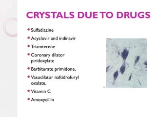 CRYSTALS DUE TO DRUGS
Sulfadiazine
Acyclovir

and indinavir

Triamterene
Coronary

dilator
piridoxylate

Barbiturate

primidone,

Vasodilator

naftidrofuryl

oxalate,
Vitamin

C

Amoxycillin

 
