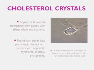 CHOLESTEROL CRYSTALS
 Appear

as brownish,
transparent thin plates, with
sharp edges and corners.
 Found

with other lipid
particles, in the urine of
patients with nephrotic
syndrome or heavy
proteinuria.



A plate of cholesterol crystal (on its
lowest corner, a few small lipid droplets;
on the background, a hyaline cast)

 