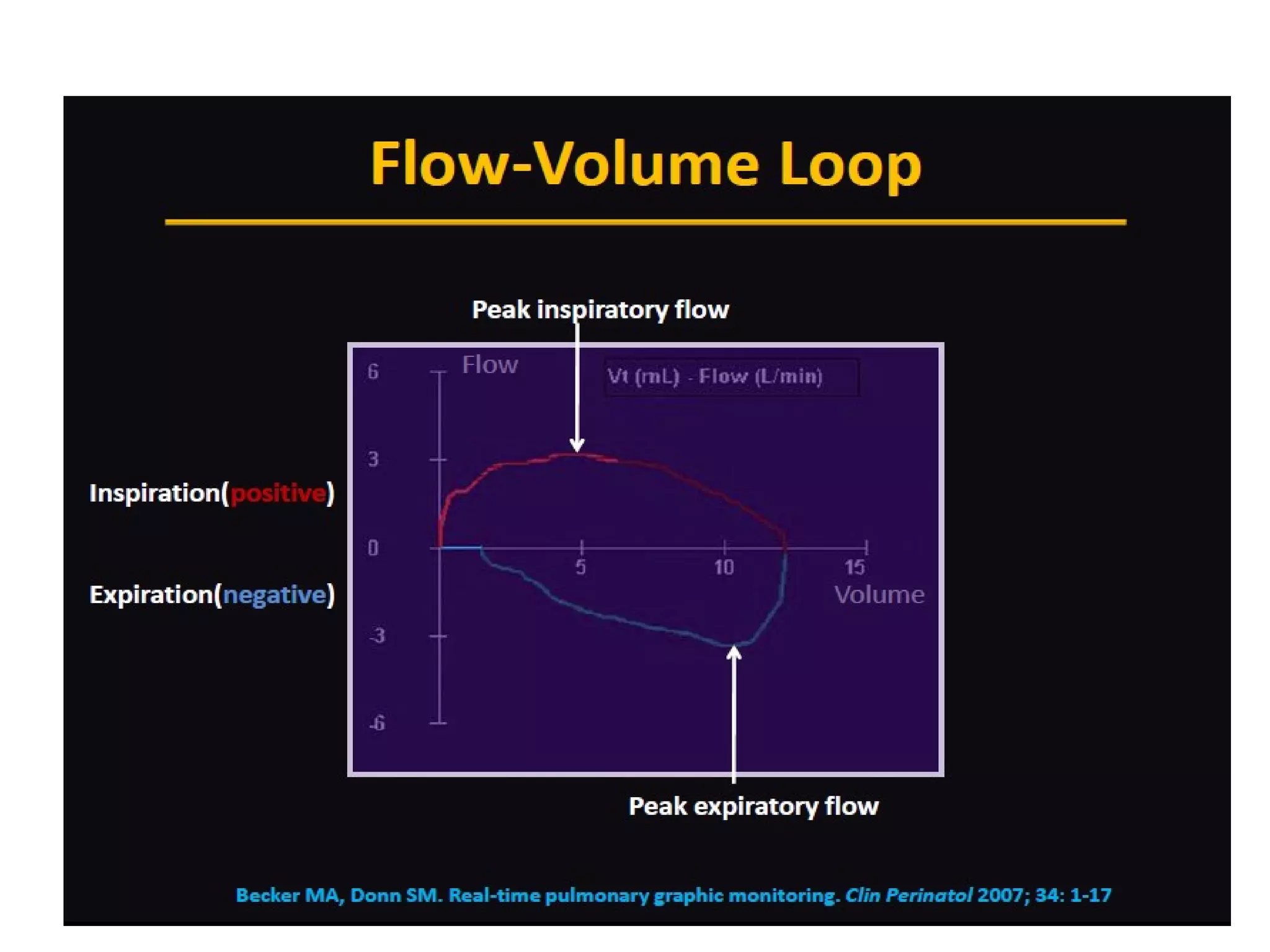 Interpretation of ventilator graphics | PPT