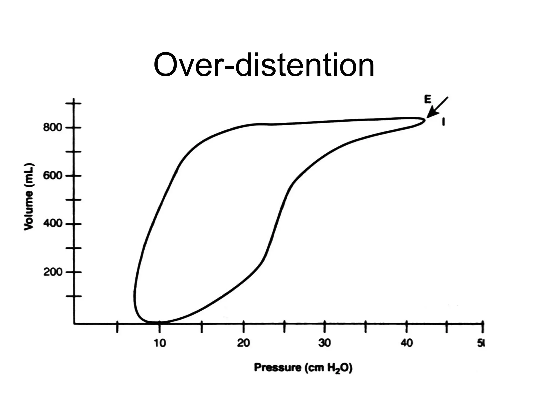 Interpretation of ventilator graphics | PPT