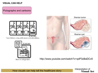 VISUAL CAN HELP

Pictographs and cartoons

http://www.youtube.com/watch?v=qdP3zBaDCv0

How visuals can help tell the healthcare story

Interpretation of

Visual Art

 