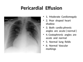 Interpretation of X- RAY FILM in medicine | PPTX