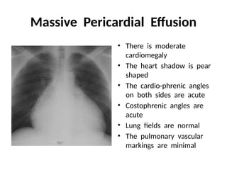 Interpretation of X- RAY FILM in medicine | PPTX