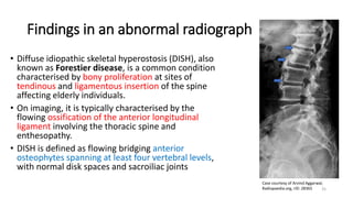 Interpretation of Xrays of the spine.pptx