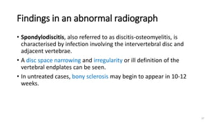 Interpretation of Xrays of the spine.pptx
