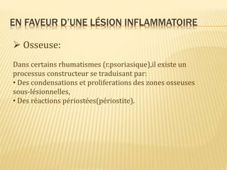 EN FAVEUR D’UNE LÉSION INFLAMMATOIRE
 Osseuse:
Dans certains rhumatismes (r.psoriasique),il existe un
processus constructeur se traduisant par:
• Des condensations et proliferations des zones osseuses
sous-lésionnelles,
• Des réactions périostées(périostite).
 