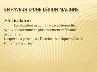 EN FAVEUR D’UNE LÉSION MALIGNE
Articulaire :
Localisation articulaire exceptionnelle:
synovialosarcome et plus rarement métastase
articulaire.
L’aspect est proche de l’atteinte septique et/ou des
tumeurs osseuses.
 