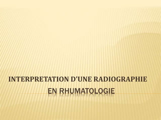 EN RHUMATOLOGIE
INTERPRETATION D’UNE RADIOGRAPHIE
 