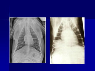 Roberts View Radiographs interpretations_of_radiographs2022.ppt