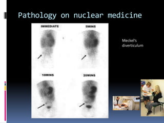 Interpret axr and imaging of gist system | PPTX