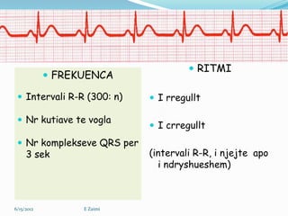 Interpretimi elektrokardiografik i crregullimeve te rritmit | PPSX