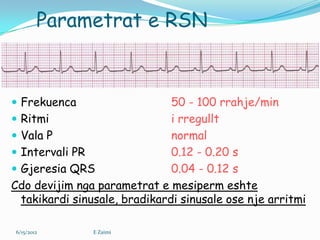 Normal Rsn Face Interpretimi elektrokardiografik i crregullimeve te rritmit | PPSX