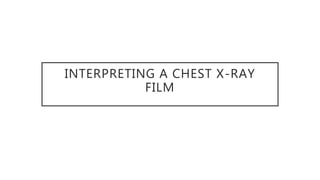 INTERPRETING A CHEST X-RAY
FILM
 