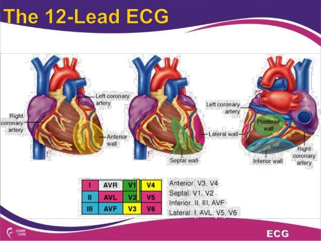 Interpreting Ecg