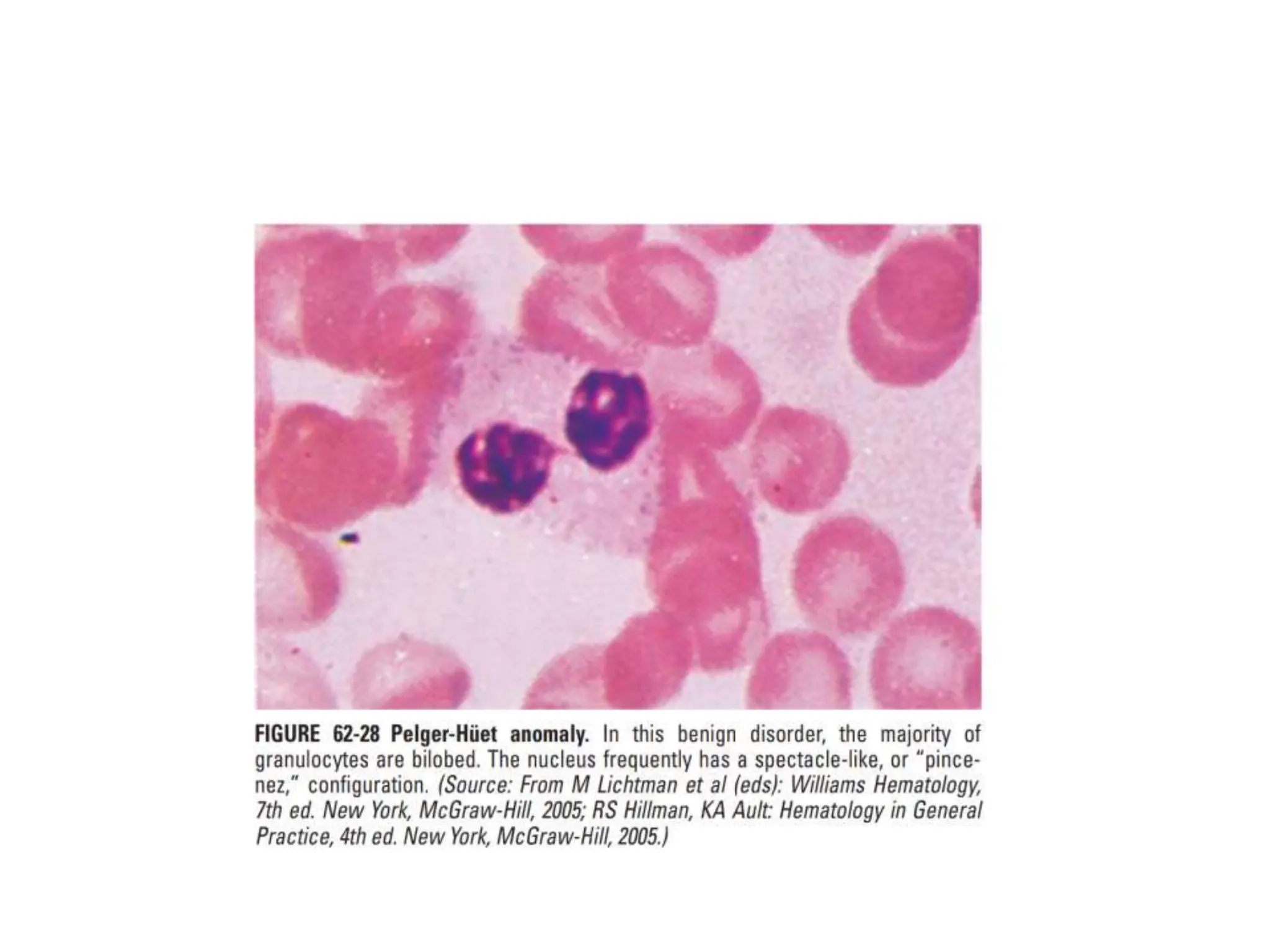 interpreting peripheral blood smears.pptx