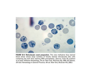 interpreting peripheral blood smears.pptx