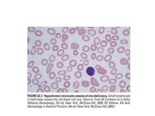 interpreting peripheral blood smears.pptx