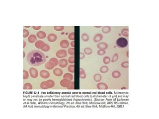 interpreting peripheral blood smears.pptx