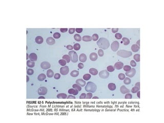 interpreting peripheral blood smears.pptx