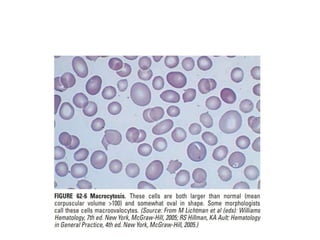 interpreting peripheral blood smears.pptx