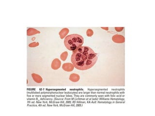 interpreting peripheral blood smears.pptx