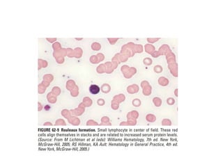 interpreting peripheral blood smears.pptx