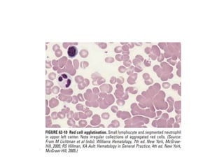 interpreting peripheral blood smears.pptx