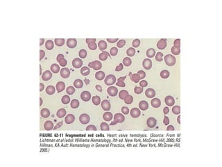 interpreting peripheral blood smears.pptx