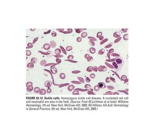 interpreting peripheral blood smears.pptx