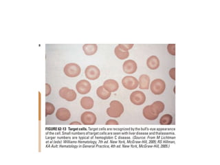 interpreting peripheral blood smears.pptx