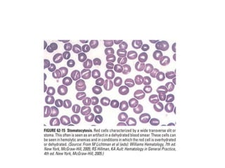 interpreting peripheral blood smears.pptx