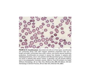 interpreting peripheral blood smears.pptx